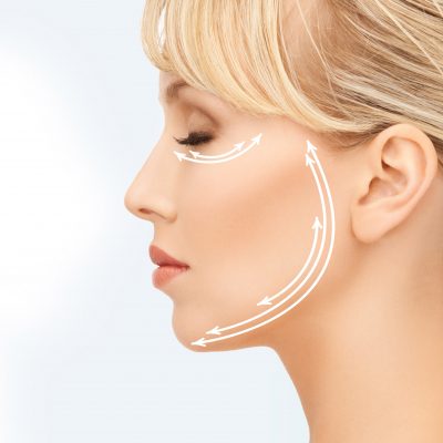 Flacidez facial